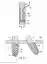 Fig. 09 - Method and device for producing an anchorage in human or animal tissue