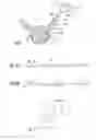 Fig. 02 - Guidewire and method for surgical procedures