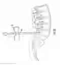 Fig. 09 - Guidewire and method for surgical procedures