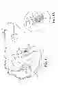 Fig. 02 - Systems and methods for fixating transvenously implanted medical devices