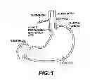 Fig. 02 - Tissue fastening devices and processes that promote tissue adhesion