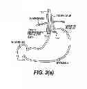 Fig. 07 - Tissue fastening devices and processes that promote tissue adhesion