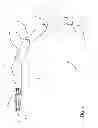 Fig. 02 - Articulating steerable clip applier for laparoscopic procedures