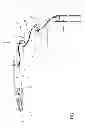 Fig. 06 - Articulating steerable clip applier for laparoscopic procedures