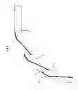Fig. 08 - Articulating steerable clip applier for laparoscopic procedures