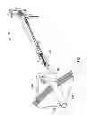 Fig. 06 - Endoscopic purse string surgical device