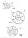 Fig. 07 - Occluding catheter and dynamic method for prevention of stroke