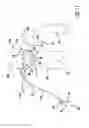 Fig. 09 - Occluding catheter and dynamic method for prevention of stroke