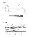 Fig. 02 - METHODS AND SYSTEMS FOR PERFORMING THROMBECTOMY PROCEDURES
