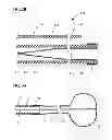 Fig. 03 - METHODS AND SYSTEMS FOR PERFORMING THROMBECTOMY PROCEDURES