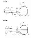 Fig. 04 - METHODS AND SYSTEMS FOR PERFORMING THROMBECTOMY PROCEDURES