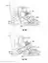 Fig. 07 - SYSTEMS AND METHODS FOR TRANSNASAL DILATION OF PASSAGEWAYS IN THE EAR, NOSE OR THROAT