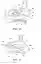 Fig. 09 - BALLOON CATHETERS AND METHODS FOR TREATING PARANASAL SINUSES