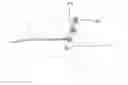 Fig. 01 - Embolic filter device and method of use thereof