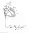 Fig. 01 - SYSTEM FOR LEFT ATRIAL APPENDAGE OCCLUSION