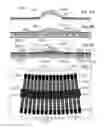 Fig. 07 - C-SPRING SUTURE FOR PRIMARY CLOSURE OF SURGICAL INCISIONS