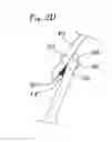 Fig. 08 - Expandable clip for tissue repair