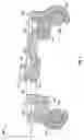 Fig. 09 - TRANVERSE VERTEBRAL CONNECTOR