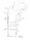 Fig. 02 - Periprosthetic bone plates