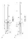 Fig. 08 - Modular telescoping surgical instrument