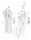 Fig. 09 - Modular telescoping surgical instrument