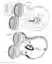 Fig. 04 - Devices and methods for non-invasive electrical stimulation and their use for vagal nerve stimulation on the neck of a patient
