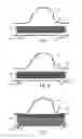 Fig. 02 - Method of radially-asymmetric stent expansion