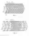 Fig. 09 - Method of radially-asymmetric stent expansion