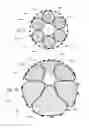 Fig. 13 - Method of radially-asymmetric stent expansion