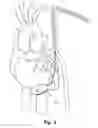 Fig. 06 - DEVICE FOR PERFORMING DIAGNOSTICS AND/OR THERAPY