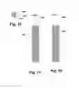 Fig. 11 - DEVICE FOR PERFORMING DIAGNOSTICS AND/OR THERAPY