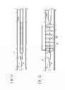 Fig. 07 - Stent graft delivery device