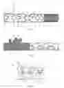 Fig. 02 - Stent graft with fixing elements and insertion system