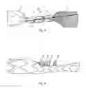 Fig. 03 - Stent graft with fixing elements and insertion system