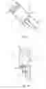 Fig. 02 - Modular stent graft