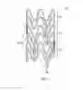 Fig. 03 - BIORESORBABLE IMPLANTS FOR TRANSMYOCARDIAL REVASCULARIZATION
