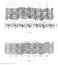 Fig. 16 - Bioabsorbable polymeric medical device
