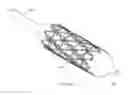 Fig. 28 - Bioabsorbable polymeric medical device