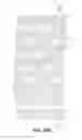 Fig. 50 - Bioabsorbable polymeric medical device