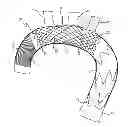 Fig. 01 - Intraluminal vascular prosthesis