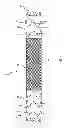 Fig. 03 - Intraluminal vascular prosthesis