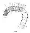 Fig. 04 - Intraluminal vascular prosthesis