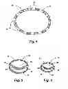 Fig. 02 - METHODS AND APPARATUS FOR CONTROLLING THE INTERNAL CIRCUMFERENCE OF AN ANATOMIC ORIFICE OR LUMEN