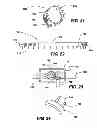 Fig. 09 - METHODS AND APPARATUS FOR CONTROLLING THE INTERNAL CIRCUMFERENCE OF AN ANATOMIC ORIFICE OR LUMEN