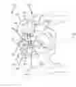 Fig. 01 - Systems for and methods of fusing a sacroiliac joint