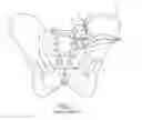 Fig. 02 - Systems for and methods of fusing a sacroiliac joint
