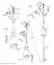 Fig. 03 - Systems for and methods of fusing a sacroiliac joint