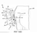 Fig. 145 - Systems for and methods of fusing a sacroiliac joint