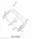 Fig. 187 - Systems for and methods of fusing a sacroiliac joint