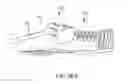 Fig. 50 - Systems for and methods of fusing a sacroiliac joint